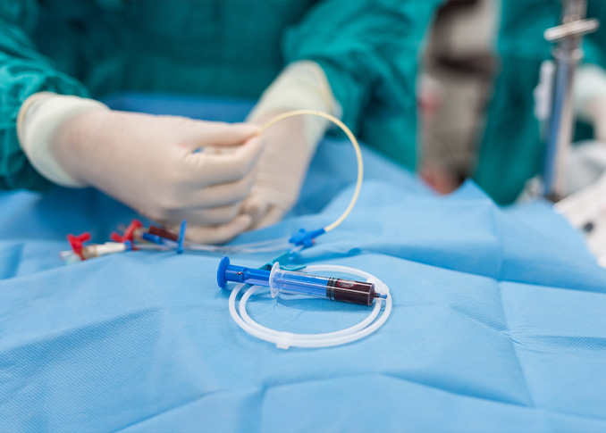 Endovascular