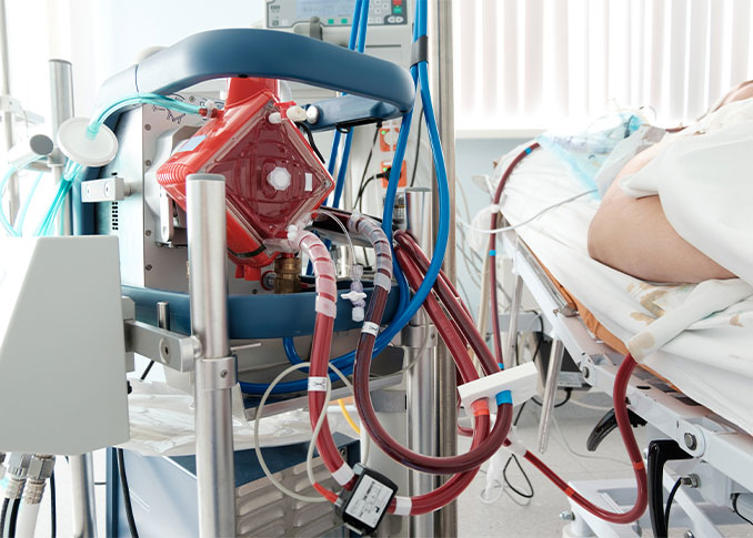 Extracorporeal Life Support