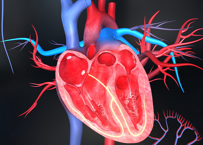 left Atrial Appendage Closure