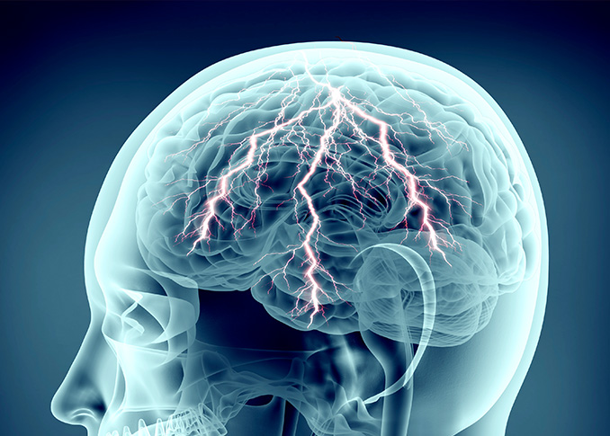 Neuromodulation