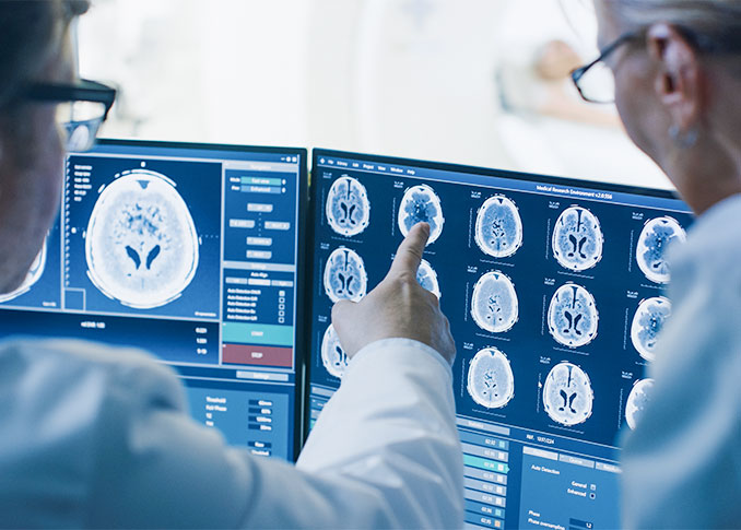 Neurovascular