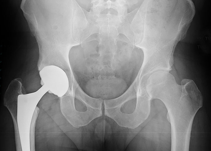 Orthopedic Surgery
