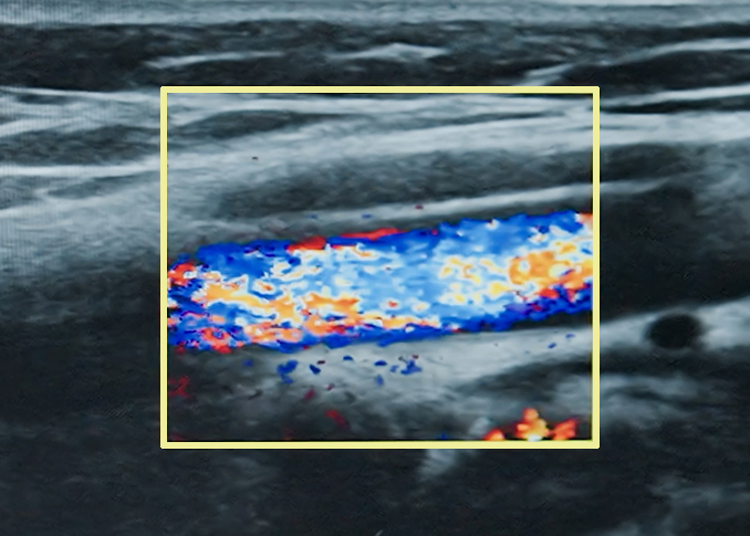 Peripheral Mapping and Diagnostics