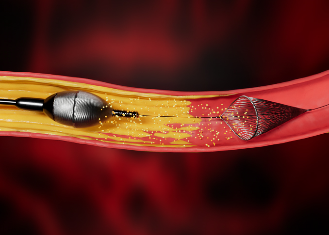 PVD-Atherectomy