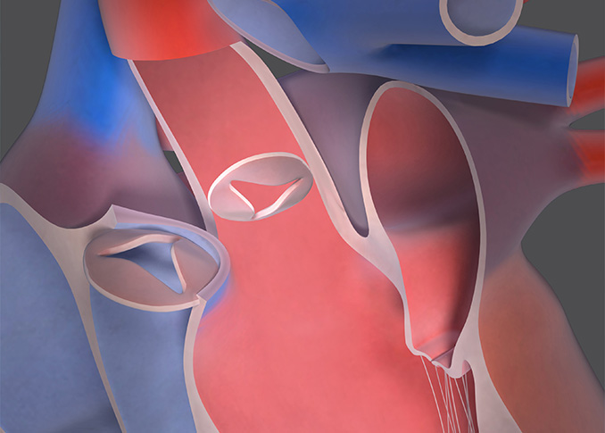 Transcatheter Aortic Valve